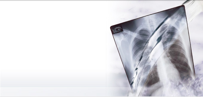 Medical X-Ray Fixer and Replenisher