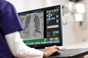 Carestream DRX-Ascend Carestream DRX-Ascend