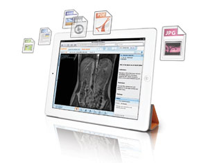 Carestream Vendor Neutral Archive Carestream Vendor Neutral Archive