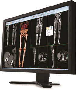 CARESTREAM Vue Radiology PACS CARESTREAM Vue Radiology PACS