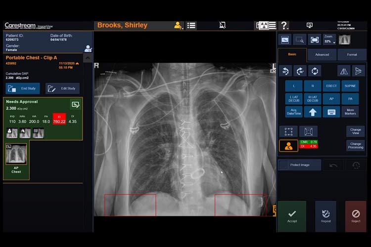 Tech Assist application with Carestream ImageView Software