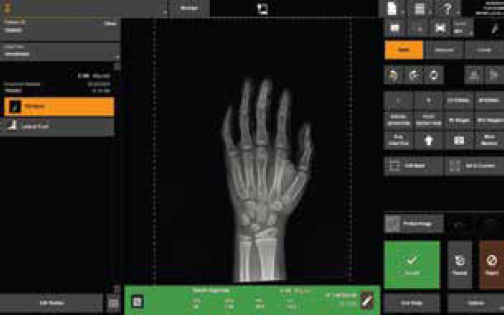 Carestream Intelligence